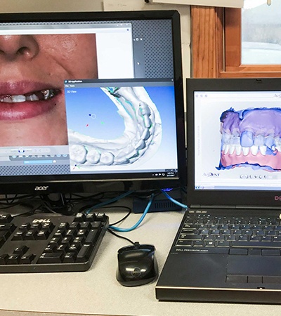 Digital images used to plant cosmetic dentistry treatment