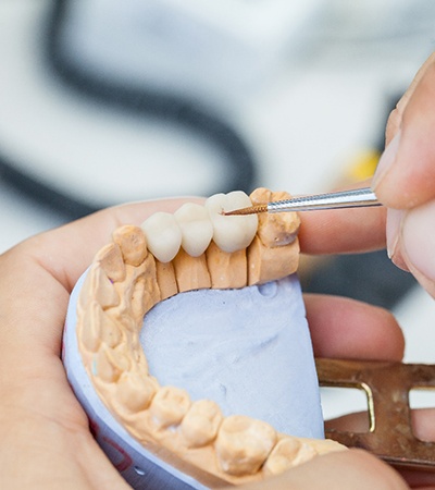 A dental technician working with dental crowns in Dayton