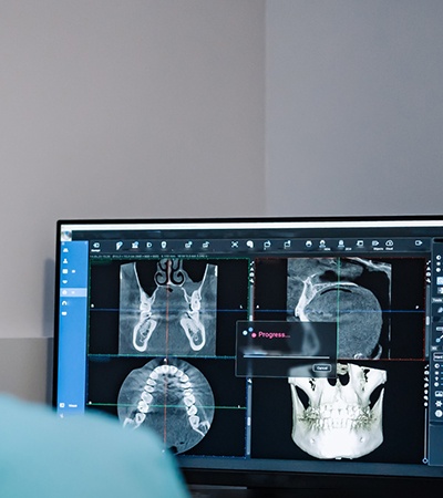 Dentist using computer to plan oral surgery