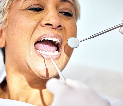 Woman with gray hair opening mouth for dental examination