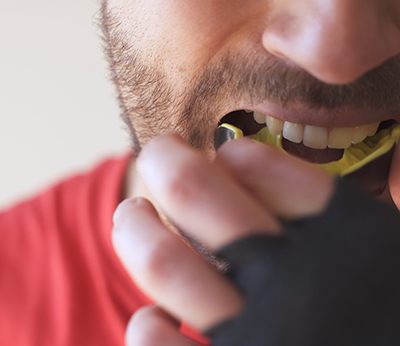 Closeup of man removing yellow mouthguard from upper arch