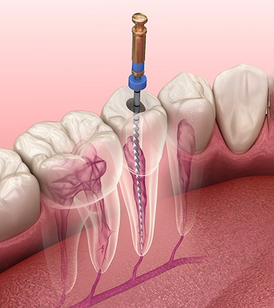 A smiling man who received effective dental care