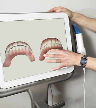 Intraoral images on chairside computer