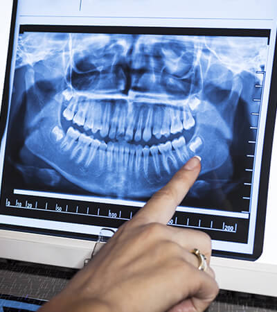 Digital dental x-rays on chairside computer monitor