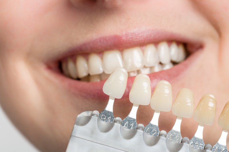 dentist holding a shade guide up to someone’s teeth