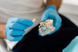 Dentist using model to explain dental implants