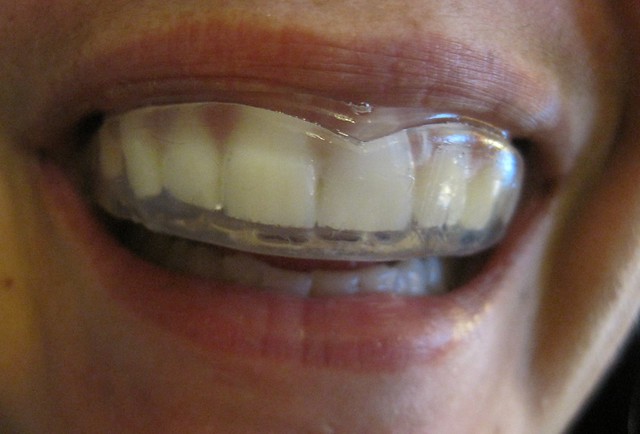 person wearing a mouthguard